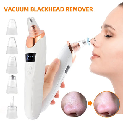 Vacuum Blackhead Remover Facial Suction Cleaner