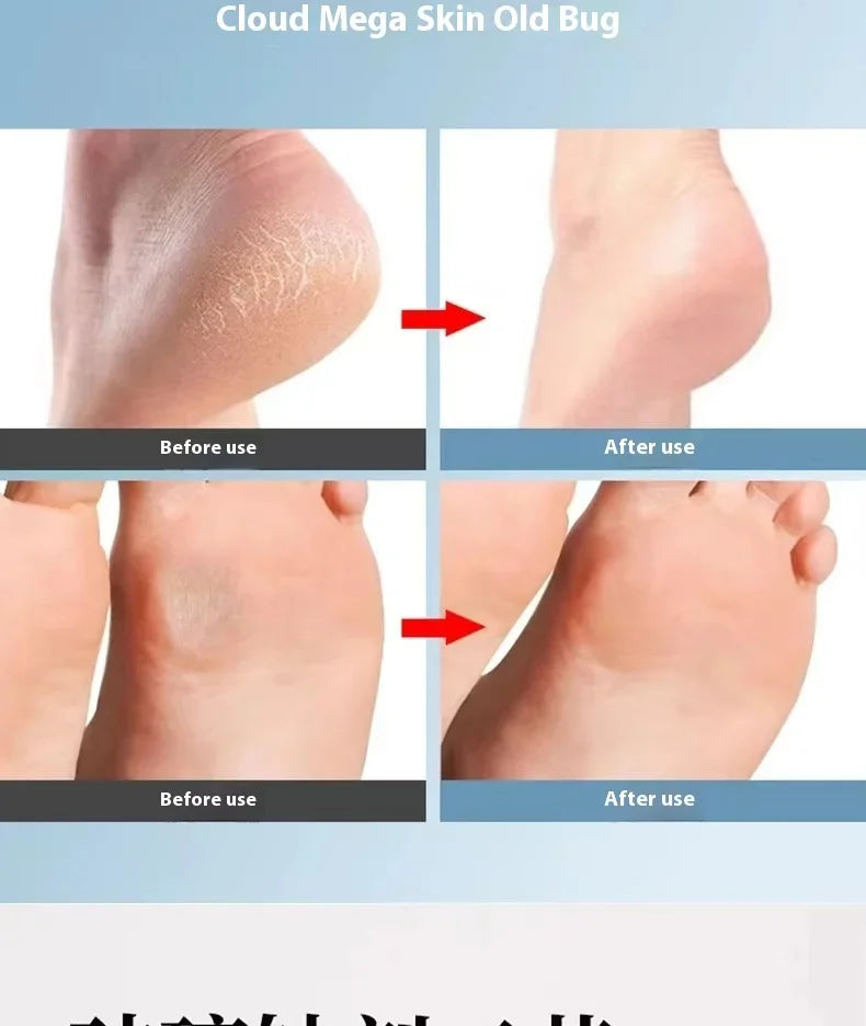 Foot Grinder Callus Remover – Nano Glass Scrubber