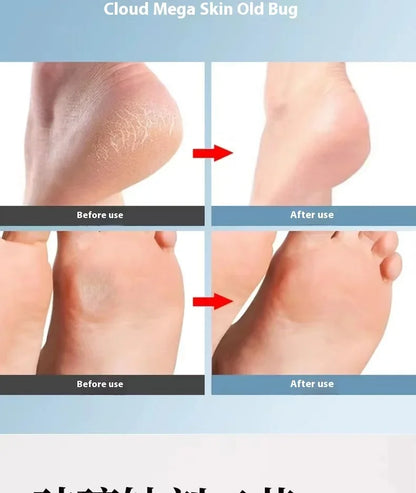 Foot Grinder Callus Remover – Nano Glass Scrubber