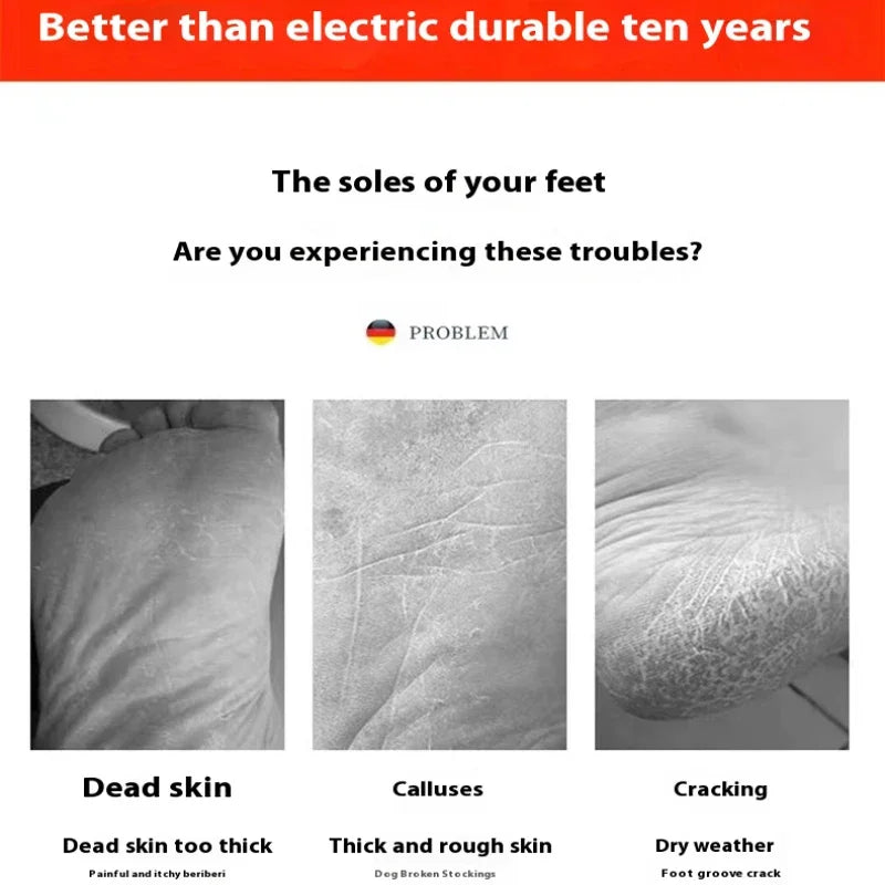Foot Grinder Callus Remover – Nano Glass Scrubber