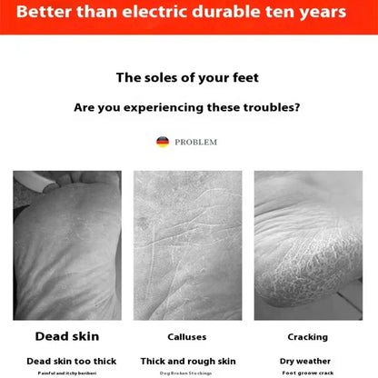 Foot Grinder Callus Remover – Nano Glass Scrubber