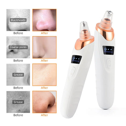 Vacuum Blackhead Remover Facial Suction Cleaner